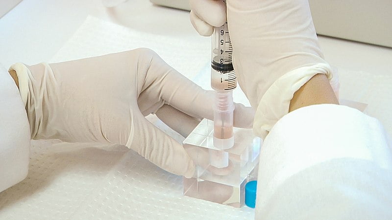 Stem cells in syringe.