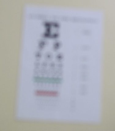 Blurry printed text on an eye chart, seen without the use of eSight glasses for the visually impaired.