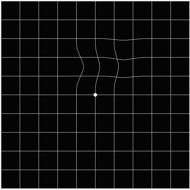 Amsler grid, looks wavy as a depiction of what people with central vision loss may see.